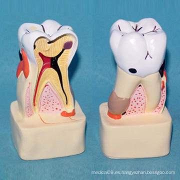 Modelo de estructura anatómica anatomía de los dientes humanos integradores (R080114)